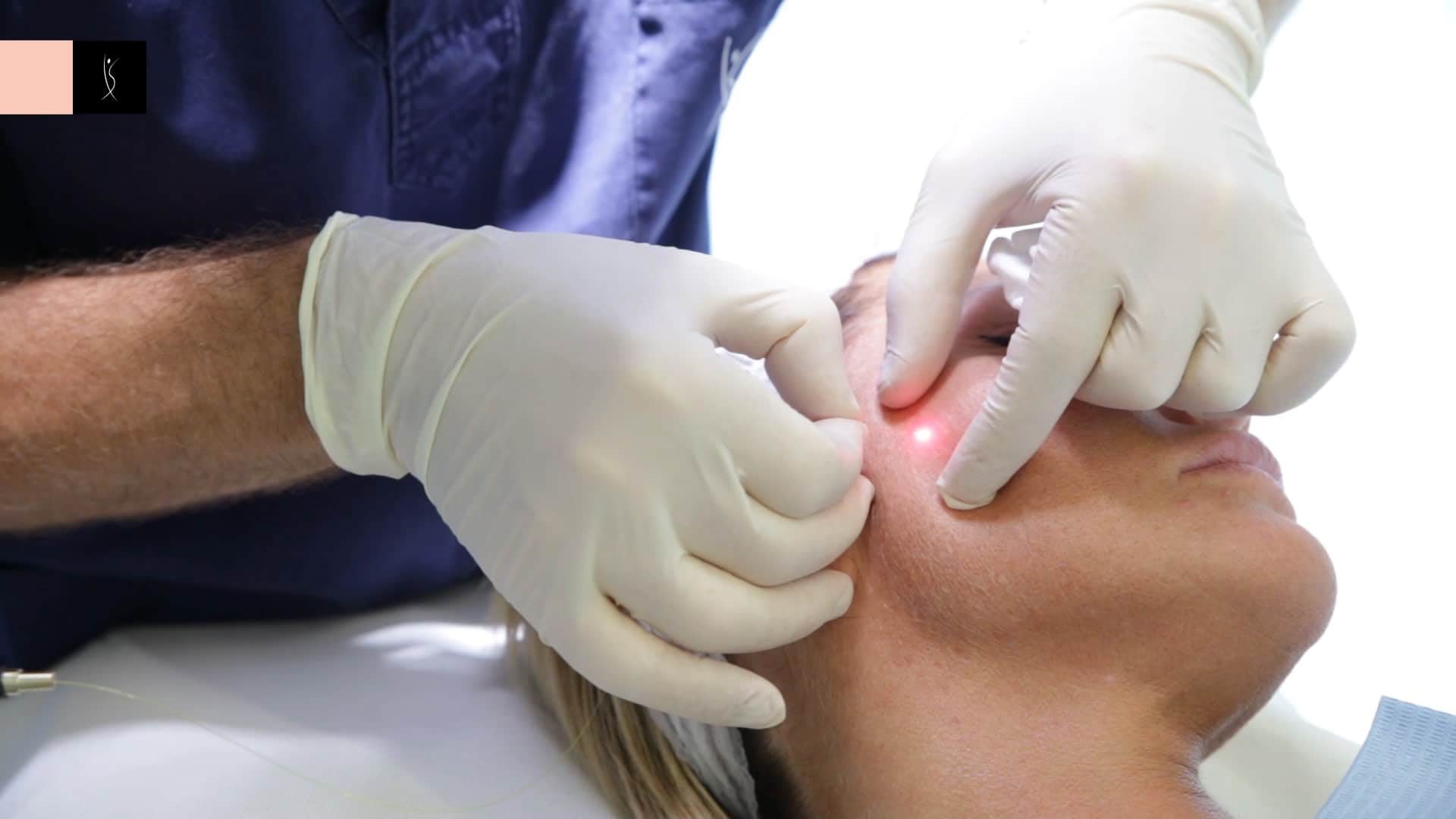 EsteCenter İstanbul'da Endolift